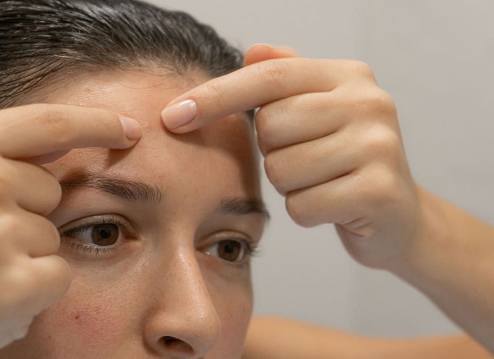 how to get rid of a pimple on your forehead